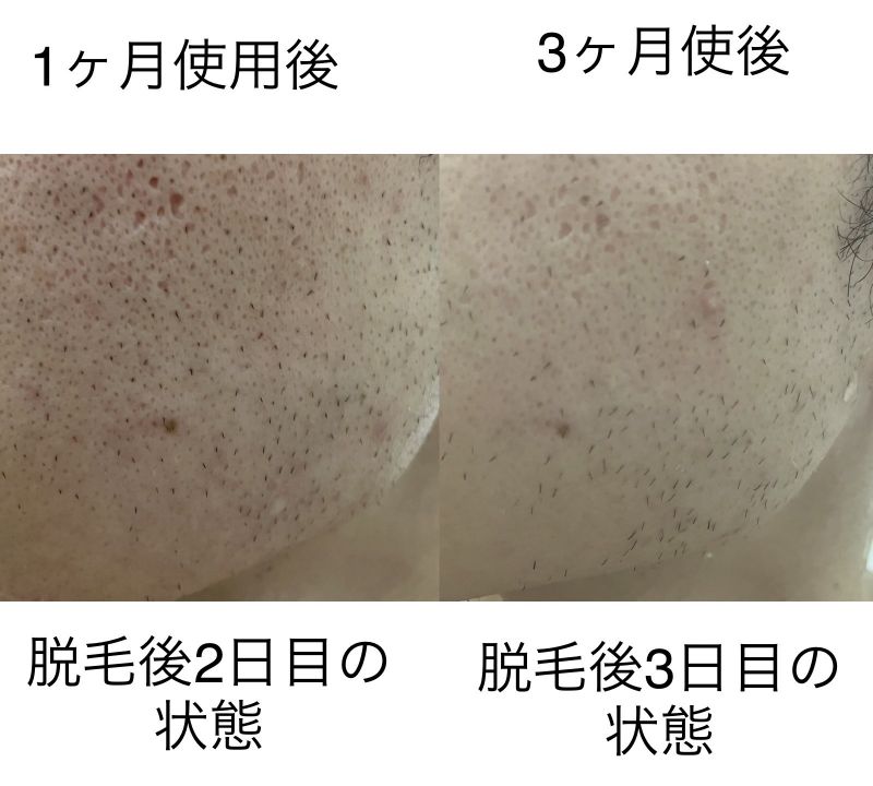 JOVS効果