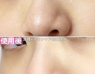 ビフォーアフター