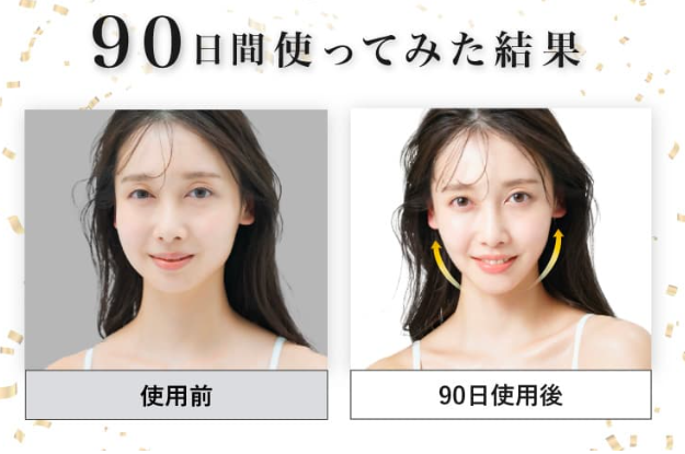 ディマーニ美顔器を使用したビフォーアフター体験談①