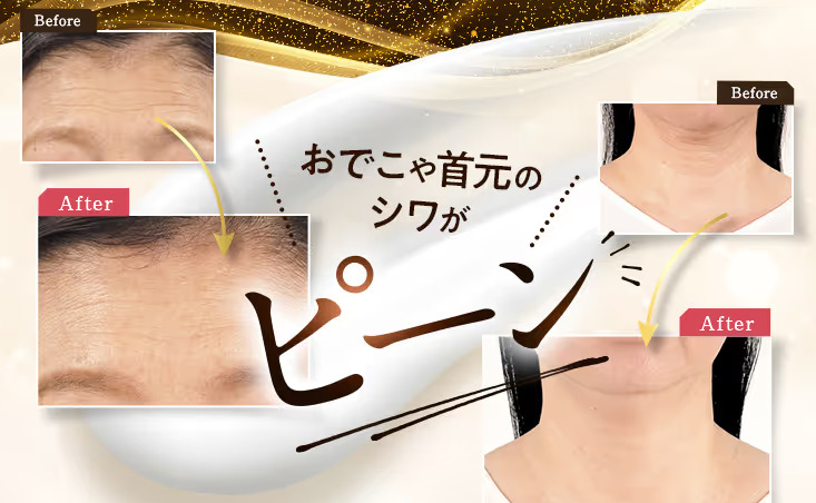 パーフェクトワン美顔器を使用したビフォーアフター体験談①
