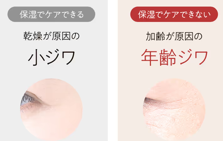 パーフェクトワン美顔器を使用したビフォーアフター体験談②