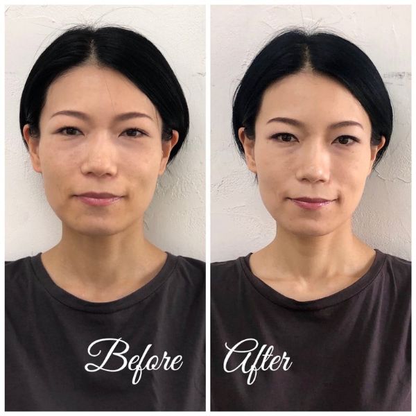 ビフォーアフター03